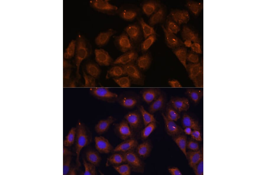 Immunofluorescence - Anti-RENT1/hUPF1 Antibody (A13486) - Antibodies.com