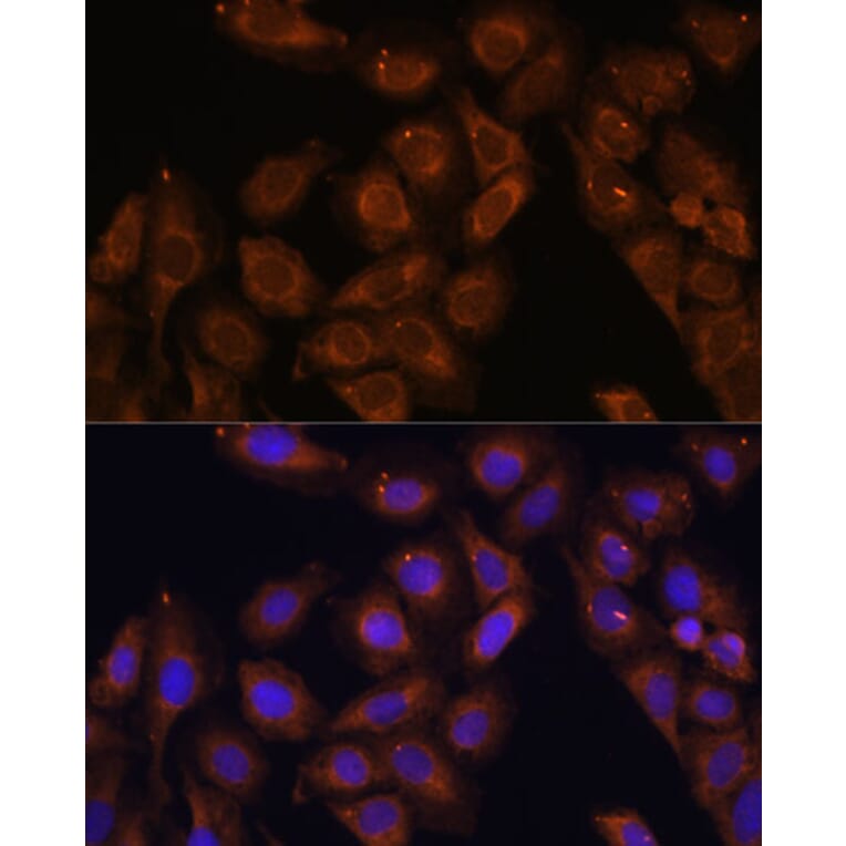 Immunofluorescence - Anti-RENT1/hUPF1 Antibody (A13486) - Antibodies.com
