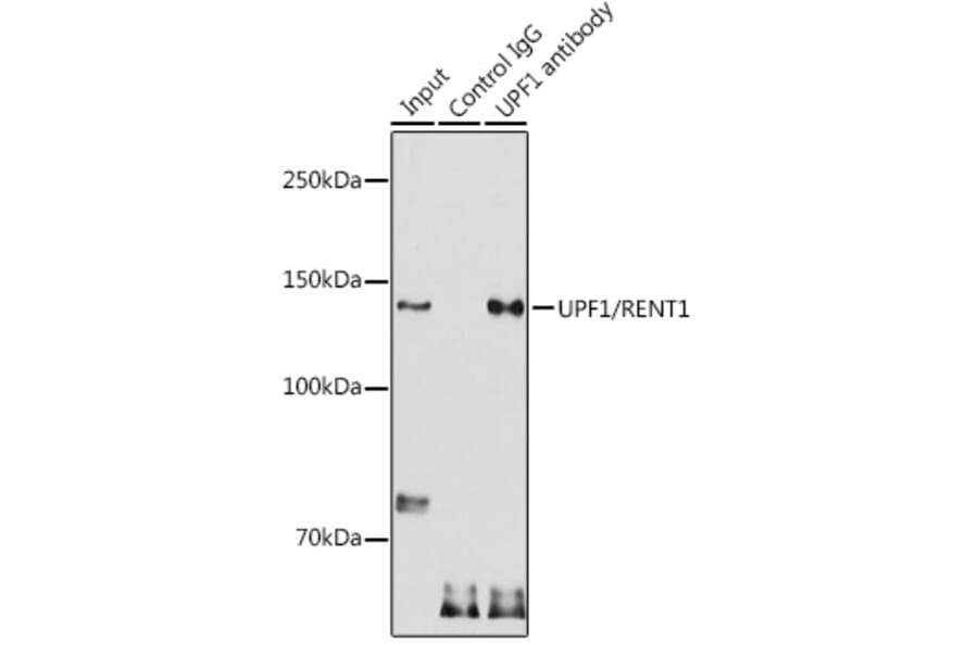 Western Blot - Anti-RENT1/hUPF1 Antibody (A13486) - Antibodies.com