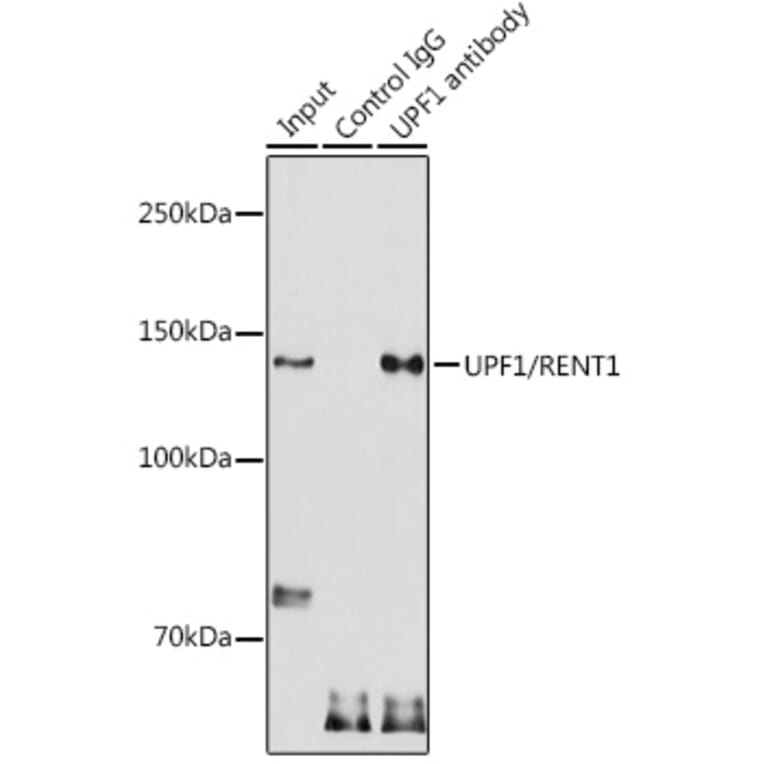 Western Blot - Anti-RENT1/hUPF1 Antibody (A13486) - Antibodies.com