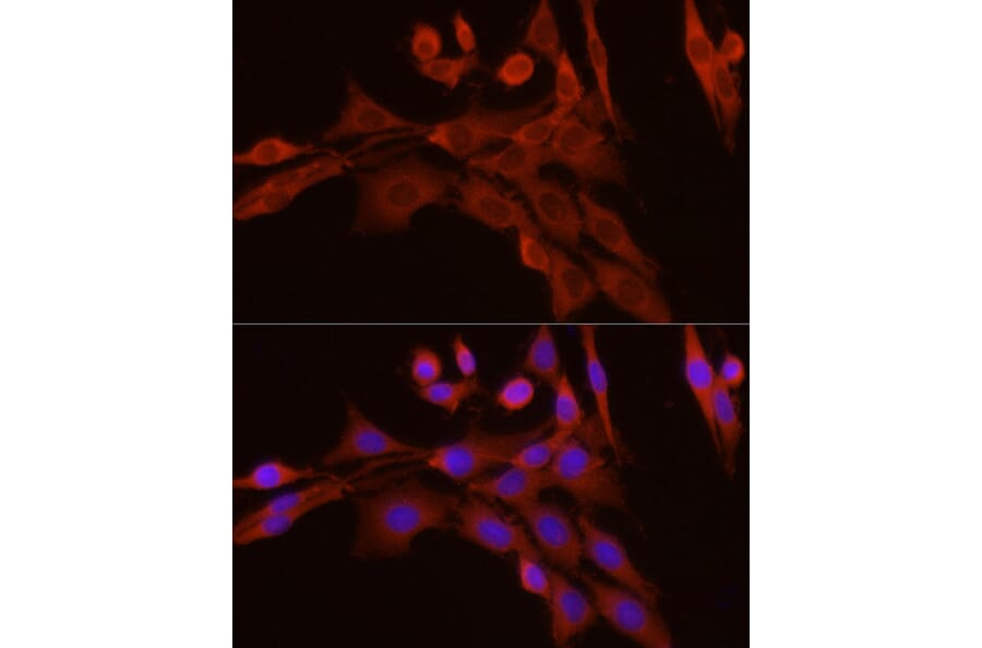 Immunofluorescence - Anti-Caspase-7 Antibody (A13487) - Antibodies.com