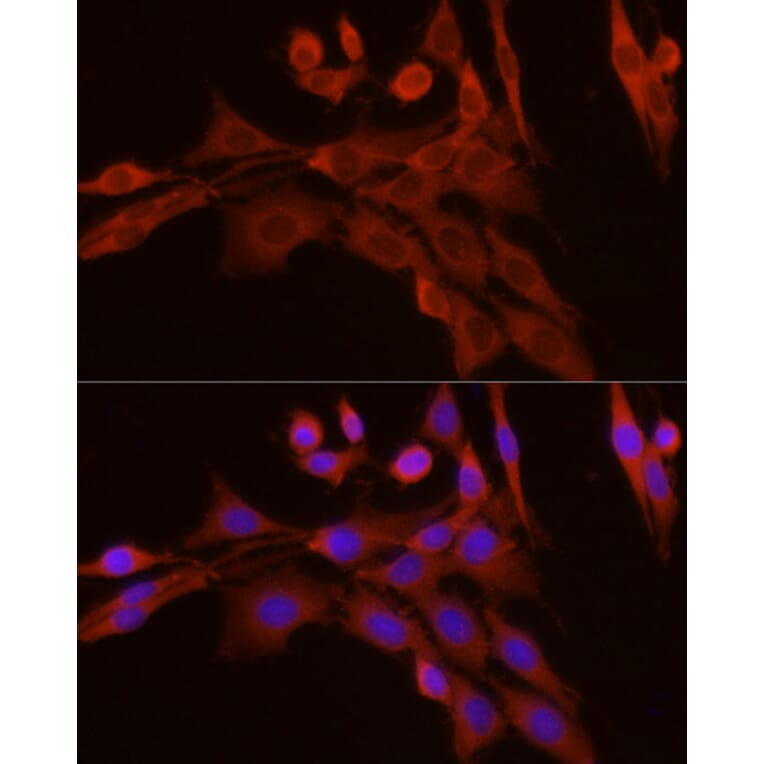 Immunofluorescence - Anti-Caspase-7 Antibody (A13487) - Antibodies.com
