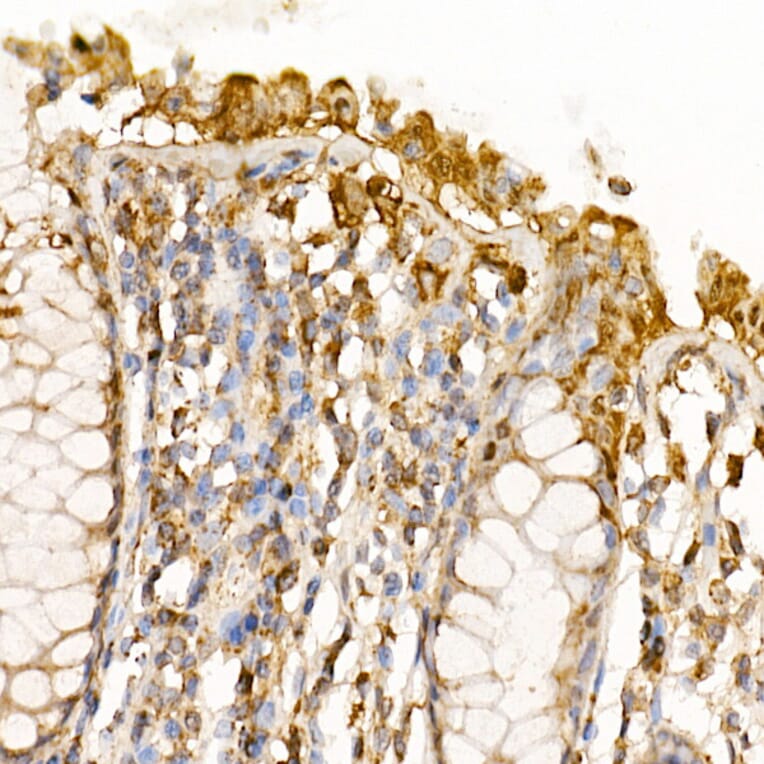 Immunohistochemistry - Anti-Caspase-7 Antibody (A13487) - Antibodies.com
