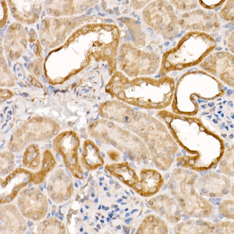 Immunohistochemistry - Anti-Caspase-7 Antibody (A13487) - Antibodies.com