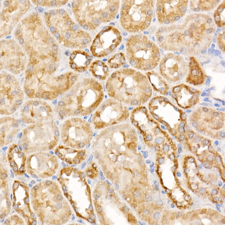 Immunohistochemistry - Anti-Caspase-7 Antibody (A13487) - Antibodies.com