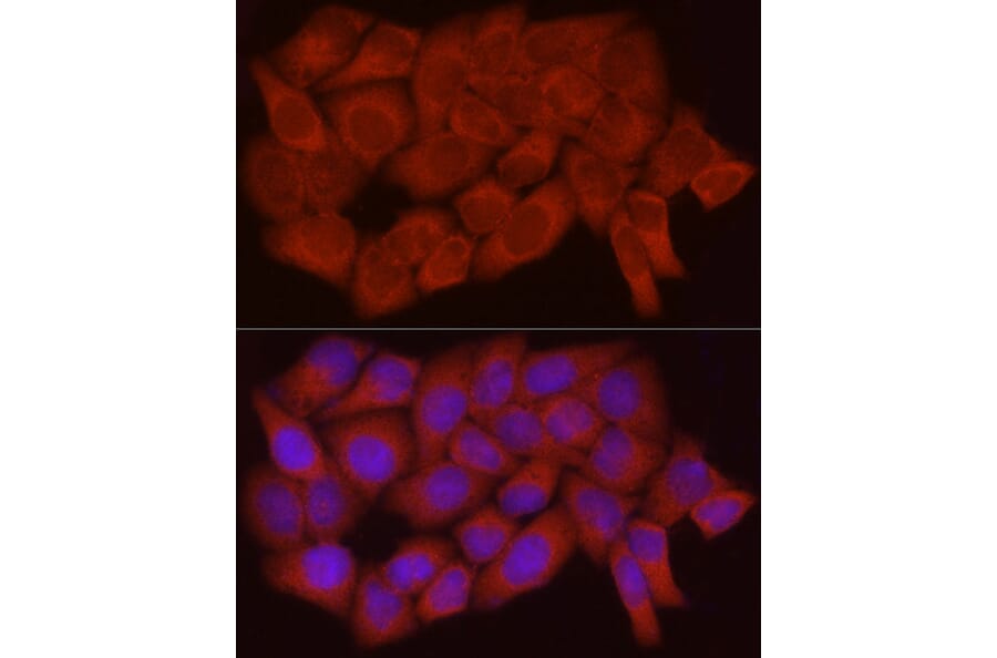 Immunofluorescence - Anti-Caspase-7 Antibody (A13487) - Antibodies.com