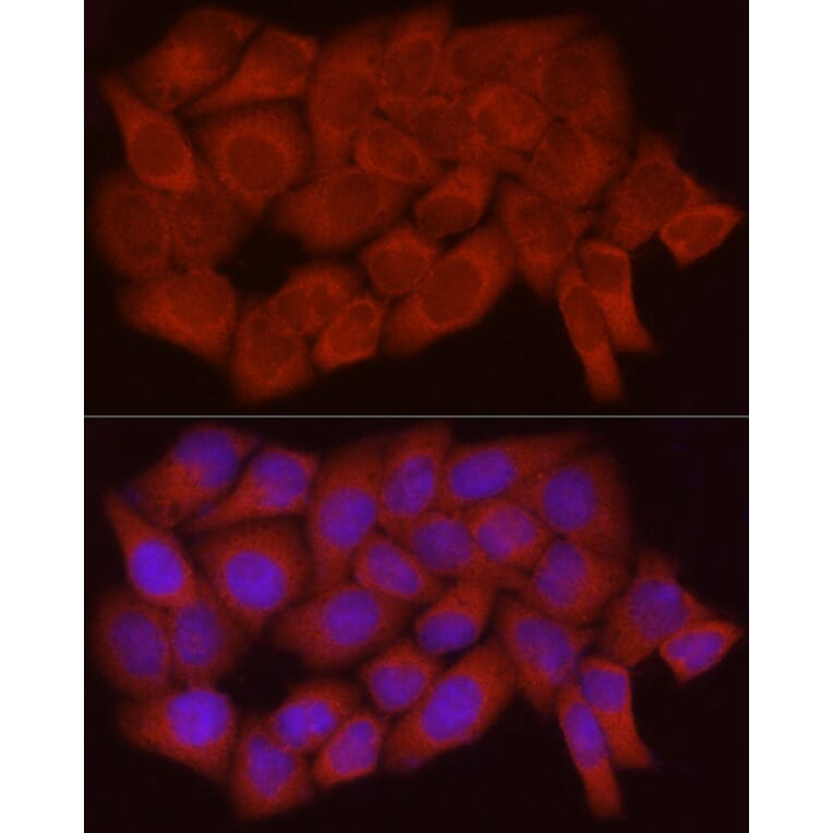 Immunofluorescence - Anti-Caspase-7 Antibody (A13487) - Antibodies.com
