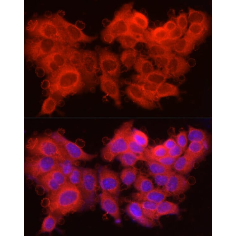 Immunofluorescence - Anti-Caspase-7 Antibody (A13487) - Antibodies.com