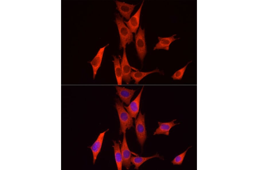 Immunofluorescence - Anti-Caspase-7 Antibody (A13487) - Antibodies.com