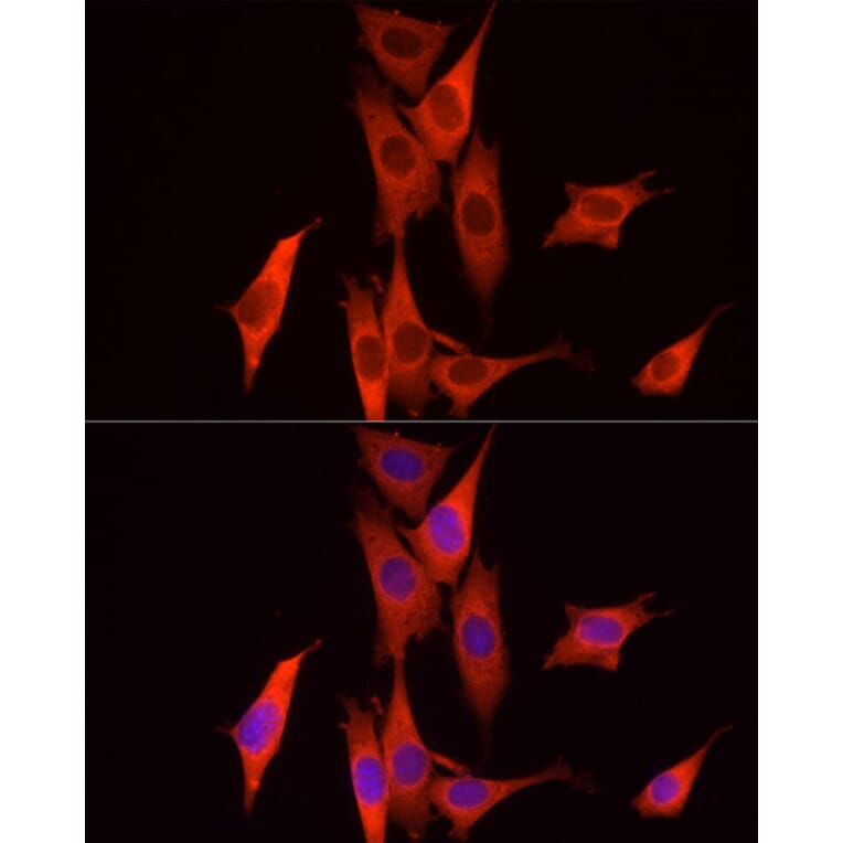 Immunofluorescence - Anti-Caspase-7 Antibody (A13487) - Antibodies.com