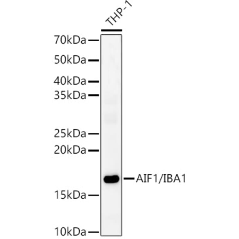 Western Blot - Anti-Iba1 Antibody (A13488) - Antibodies.com