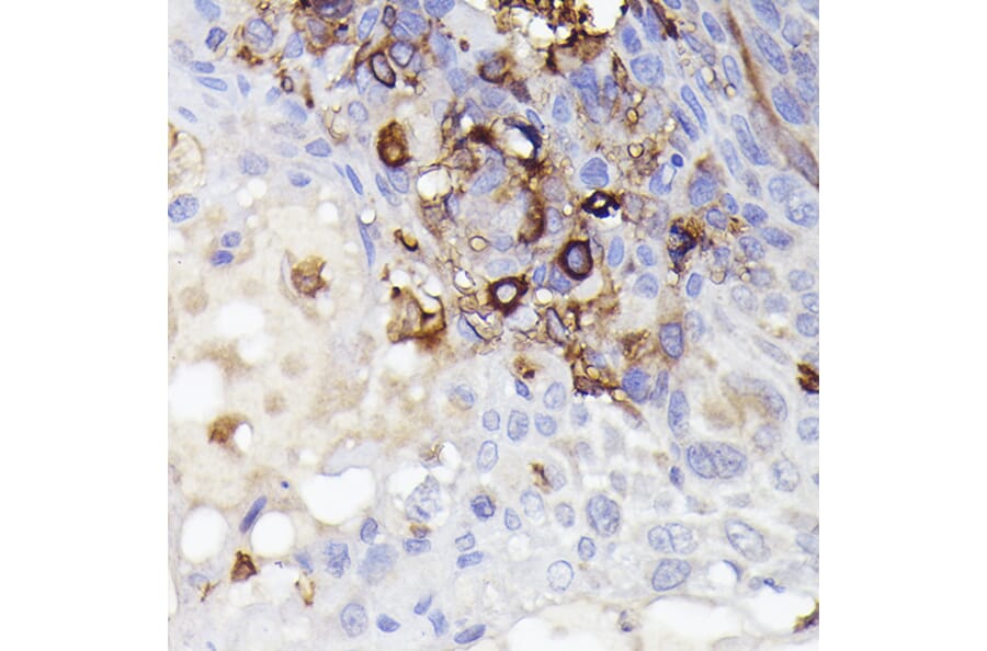 Immunohistochemistry - Anti-Iba1 Antibody (A13488) - Antibodies.com