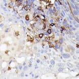 Immunohistochemistry - Anti-Iba1 Antibody (A13488) - Antibodies.com