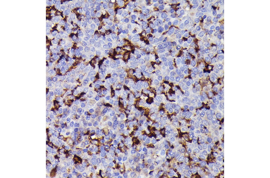 Immunohistochemistry - Anti-Iba1 Antibody (A13488) - Antibodies.com