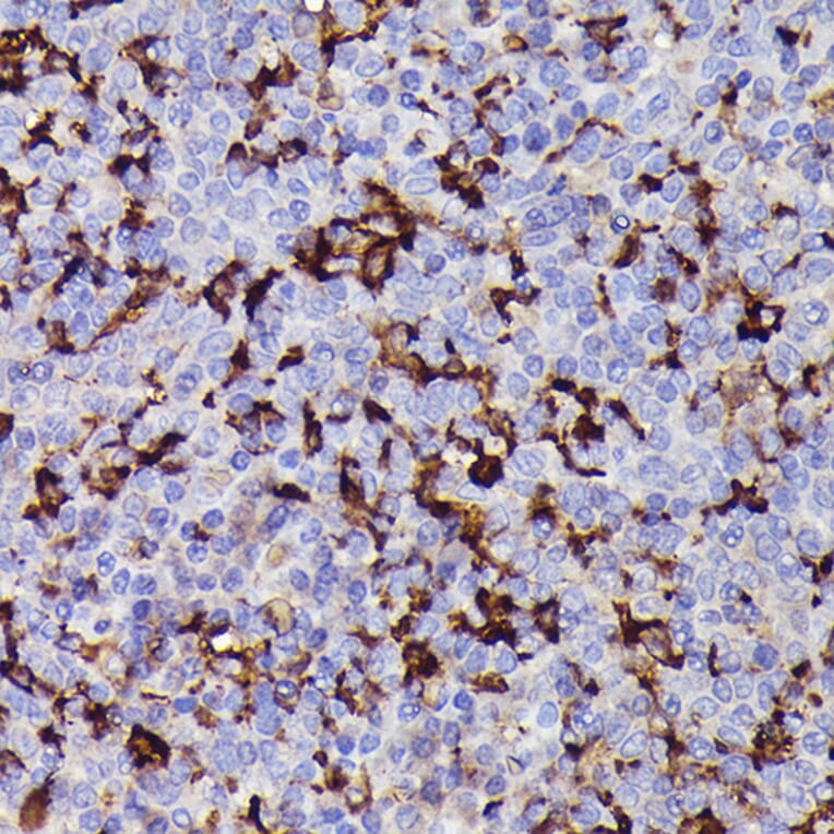 Immunohistochemistry - Anti-Iba1 Antibody (A13488) - Antibodies.com