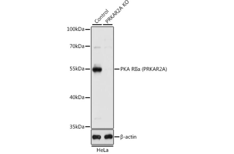 Western Blot - Anti-PKA R2/PKR2 Antibody (A13489) - Antibodies.com