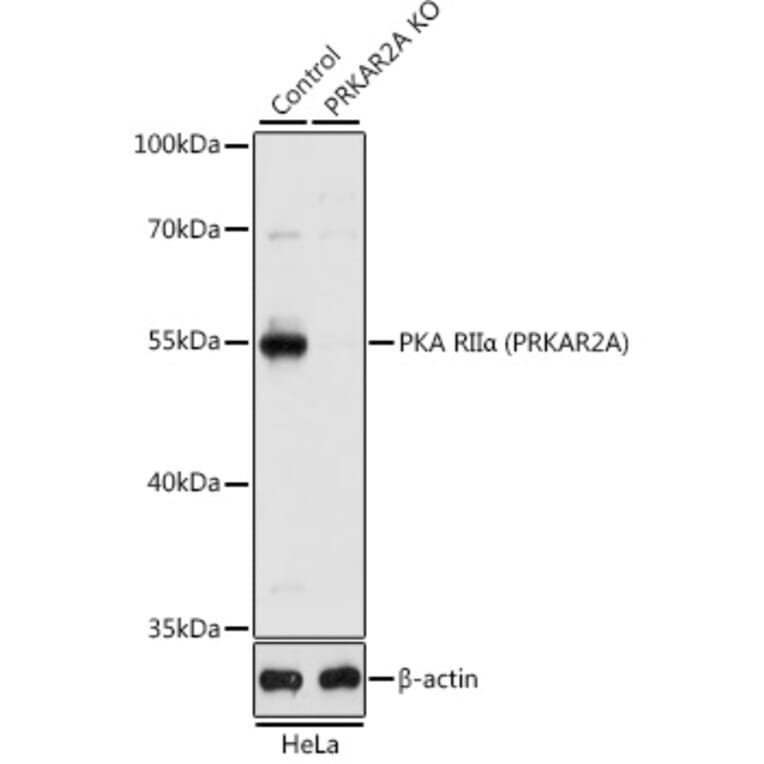 Western Blot - Anti-PKA R2/PKR2 Antibody (A13489) - Antibodies.com