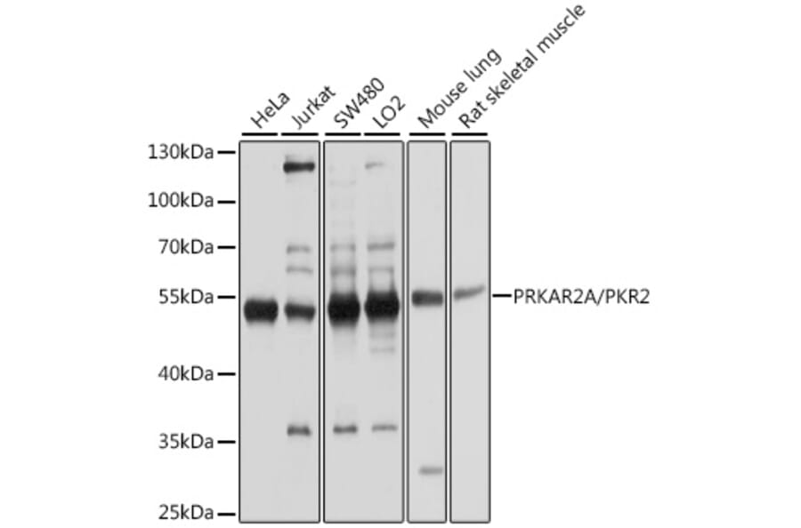 Western Blot - Anti-PKA R2/PKR2 Antibody (A13489) - Antibodies.com