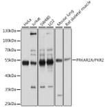 Western Blot - Anti-PKA R2/PKR2 Antibody (A13489) - Antibodies.com