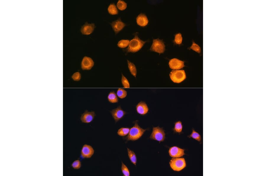 Immunofluorescence - Anti-PKA R2/PKR2 Antibody (A13489) - Antibodies.com