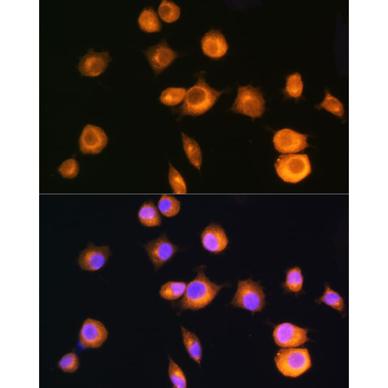 Immunofluorescence - Anti-PKA R2/PKR2 Antibody (A13489) - Antibodies.com