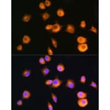 Immunofluorescence - Anti-PKA R2/PKR2 Antibody (A13489) - Antibodies.com
