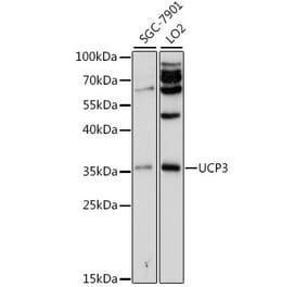 Western Blot - Anti-UCP3 Antibody (A13490) - Antibodies.com