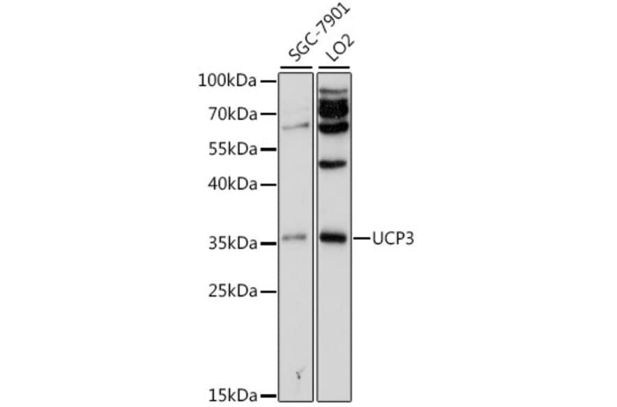 Western Blot - Anti-UCP3 Antibody (A13490) - Antibodies.com