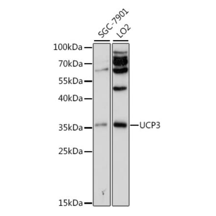 Western Blot - Anti-UCP3 Antibody (A13490) - Antibodies.com