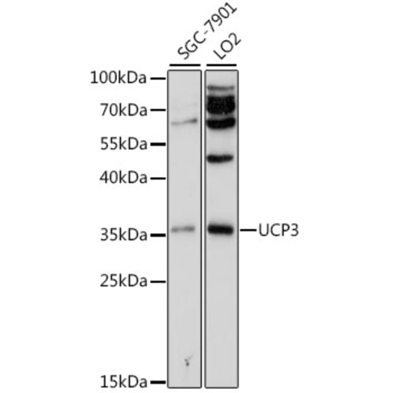 Western Blot - Anti-UCP3 Antibody (A13490) - Antibodies.com