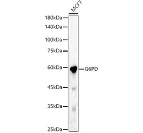 Western Blot - Anti-Glucose 6 Phosphate Dehydrogenase Antibody (A13491) - Antibodies.com
