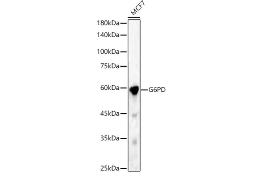 Western Blot - Anti-Glucose 6 Phosphate Dehydrogenase Antibody (A13491) - Antibodies.com