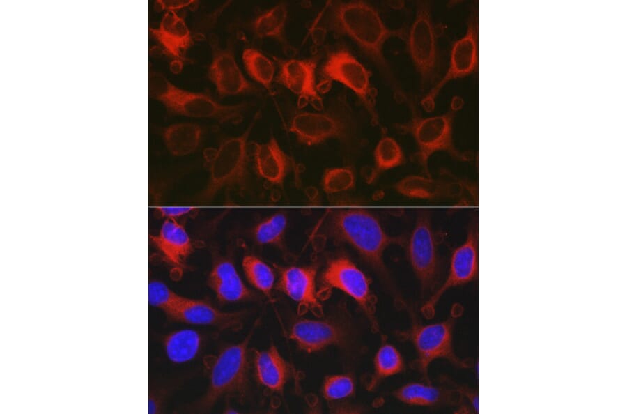 Immunofluorescence - Anti-Glucose 6 Phosphate Dehydrogenase Antibody (A13491) - Antibodies.com