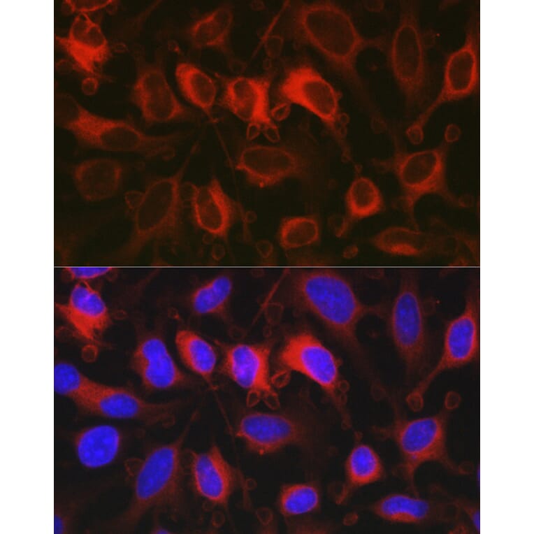 Immunofluorescence - Anti-Glucose 6 Phosphate Dehydrogenase Antibody (A13491) - Antibodies.com