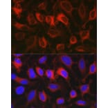 Immunofluorescence - Anti-Glucose 6 Phosphate Dehydrogenase Antibody (A13491) - Antibodies.com