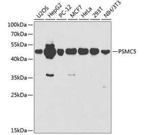 Western Blot - Anti-PSMC5 Antibody (A13492) - Antibodies.com