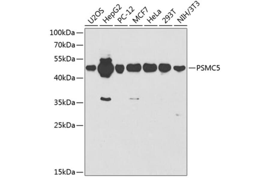 Western Blot - Anti-PSMC5 Antibody (A13492) - Antibodies.com