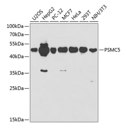 Western Blot - Anti-PSMC5 Antibody (A13492) - Antibodies.com