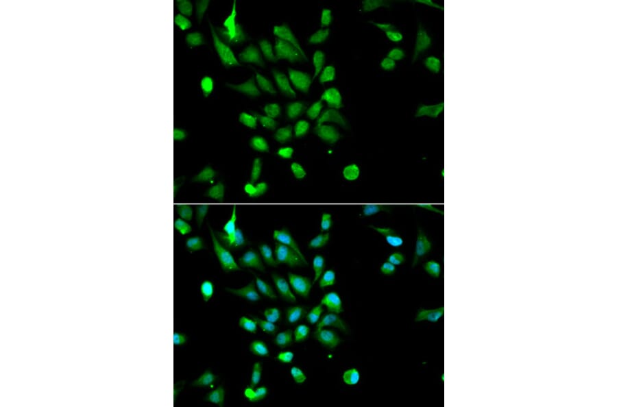 Immunofluorescence - Anti-PSMC5 Antibody (A13492) - Antibodies.com