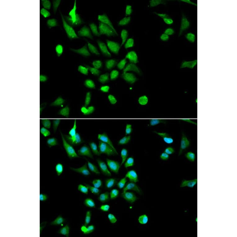 Immunofluorescence - Anti-PSMC5 Antibody (A13492) - Antibodies.com