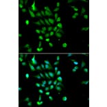 Immunofluorescence - Anti-PSMC5 Antibody (A13492) - Antibodies.com