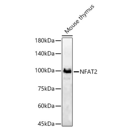 Western Blot - Anti-NFAT2 Antibody (A13493) - Antibodies.com