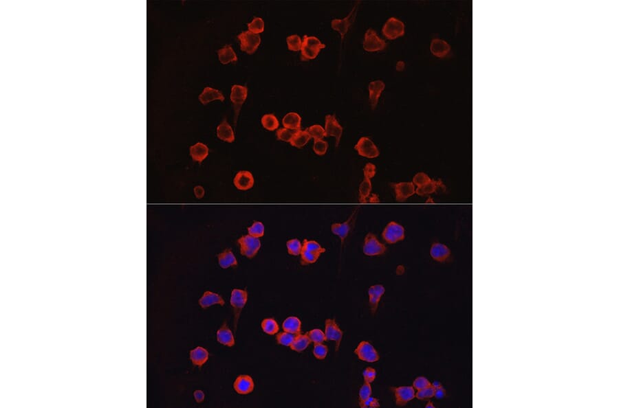 Immunofluorescence - Anti-NFAT2 Antibody (A13493) - Antibodies.com