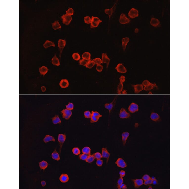 Immunofluorescence - Anti-NFAT2 Antibody (A13493) - Antibodies.com