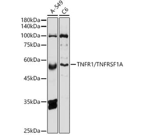 Western Blot - Anti-TNF Receptor I Antibody (A13494) - Antibodies.com