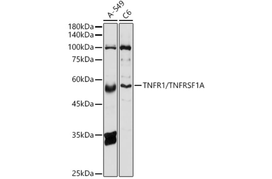 Western Blot - Anti-TNF Receptor I Antibody (A13494) - Antibodies.com