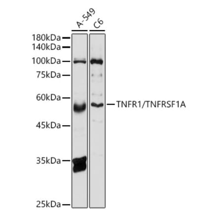 Western Blot - Anti-TNF Receptor I Antibody (A13494) - Antibodies.com