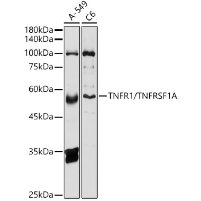 Western Blot - Anti-TNF Receptor I Antibody (A13494) - Antibodies.com