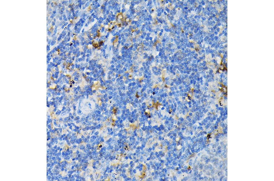 Immunohistochemistry - Anti-TNF Receptor I Antibody (A13494) - Antibodies.com