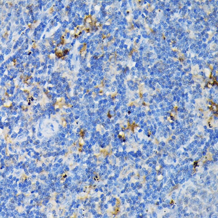 Immunohistochemistry - Anti-TNF Receptor I Antibody (A13494) - Antibodies.com